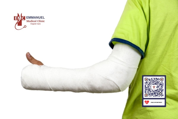 Immediate Care for a Child's Broken Arm: Steps Before Reaching the Hospital